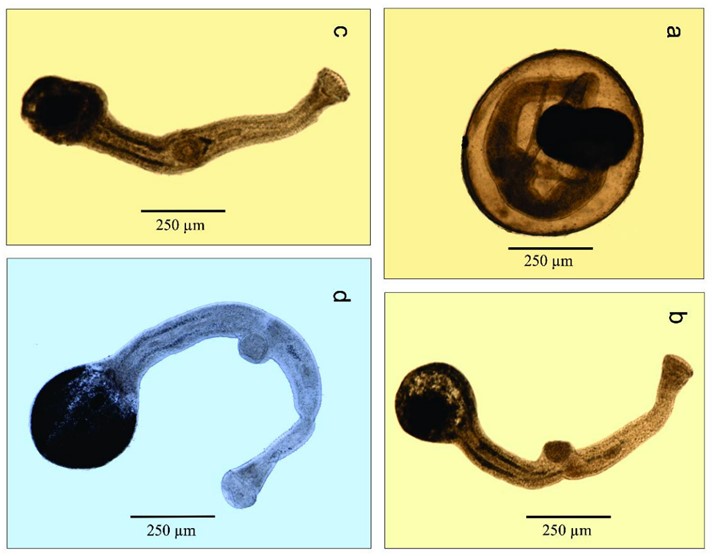 Stephanostomum minankisi n. sp. (Digenea: Acanthocolpidae) from dusky flounder Syacium papillosum (Paralichthydae) from southern Gulf of Mexico: A new species without spines?